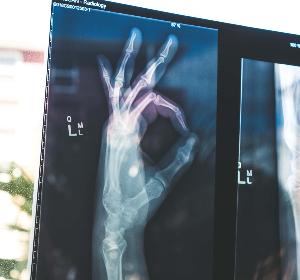 how to register for the usmle step 1 how to register for the usmle step 1