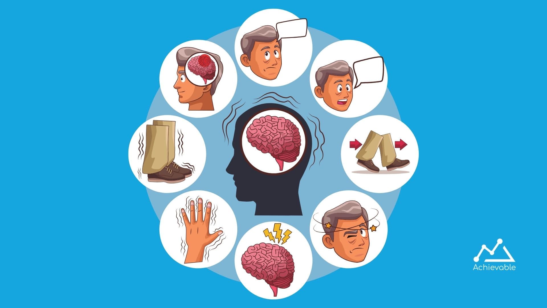 Neurodegenerative disorders of the brain and dementia on the USMLE Step 1 exam