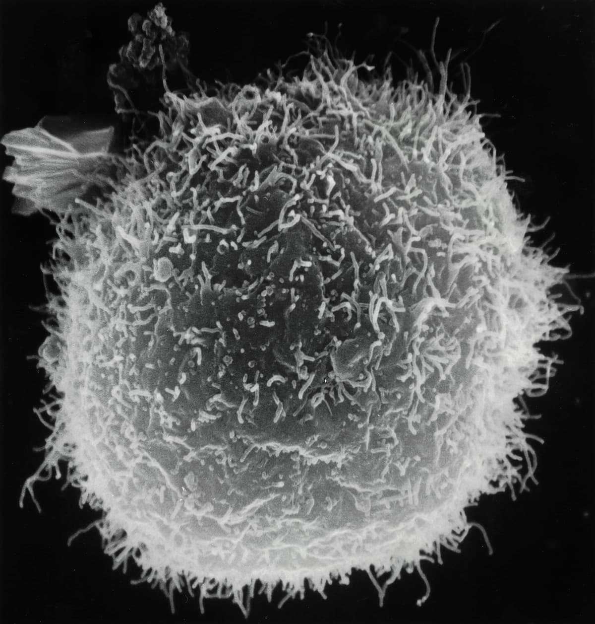 what is granuloma